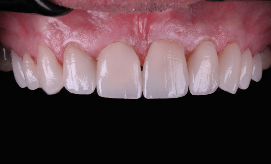 After - Wensleydale Dental Practice