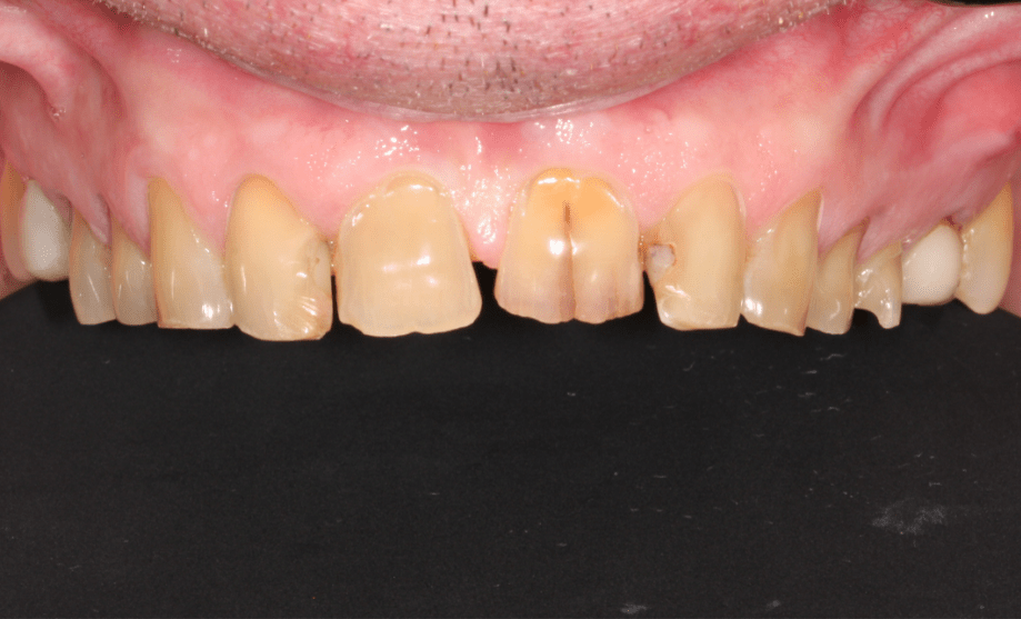 Before - Wensleydale Dental Practice