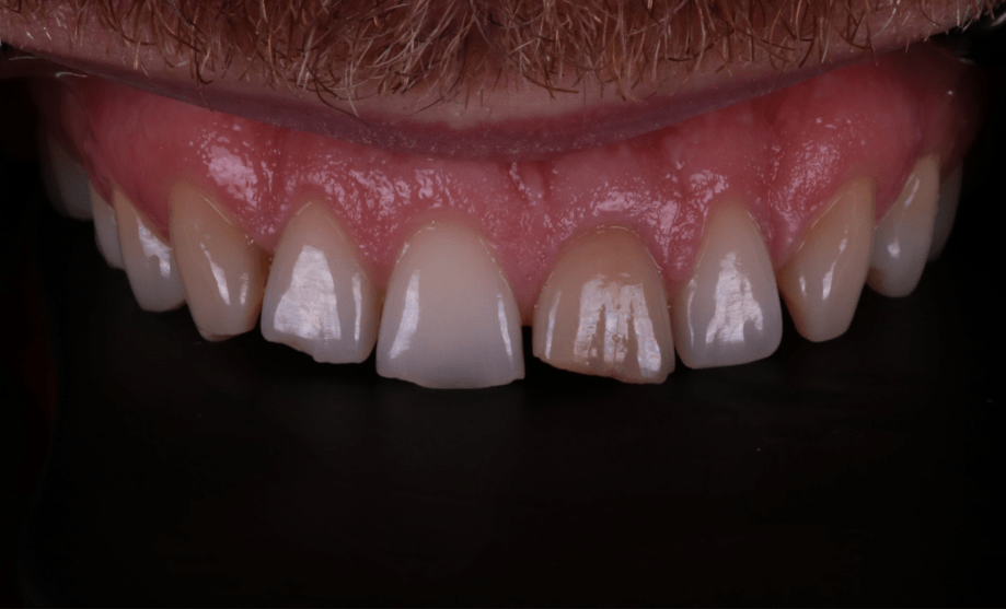 Before - Wensleydale Dental Practice