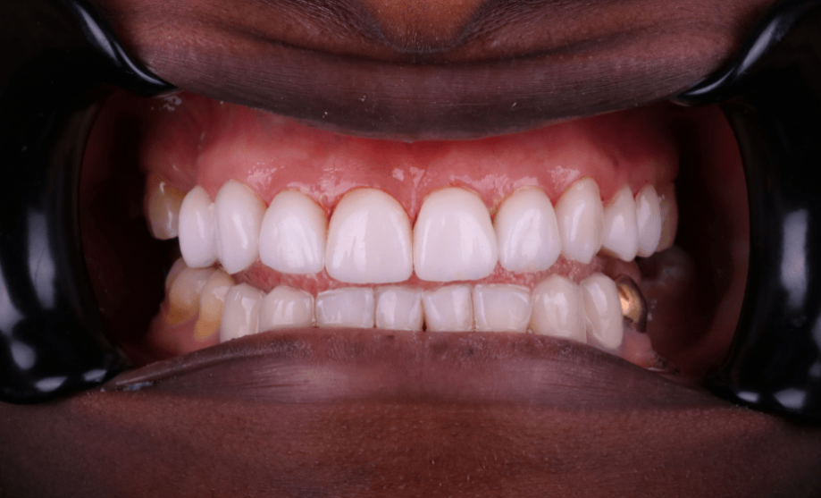 After - Wensleydale Dental Practice