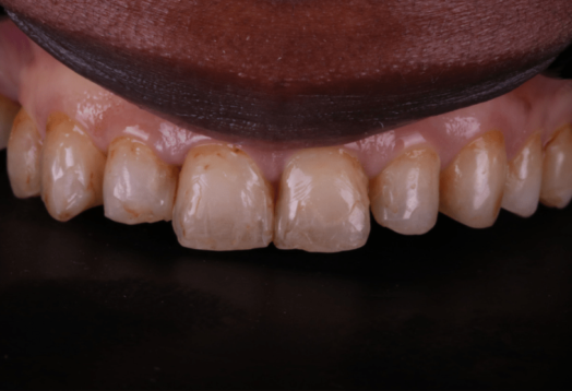 Before - Wensleydale Dental