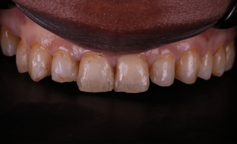 Before - Wensleydale Dental Practice