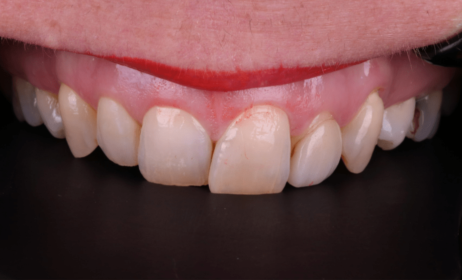 Before - Wensleydale Dental Practice