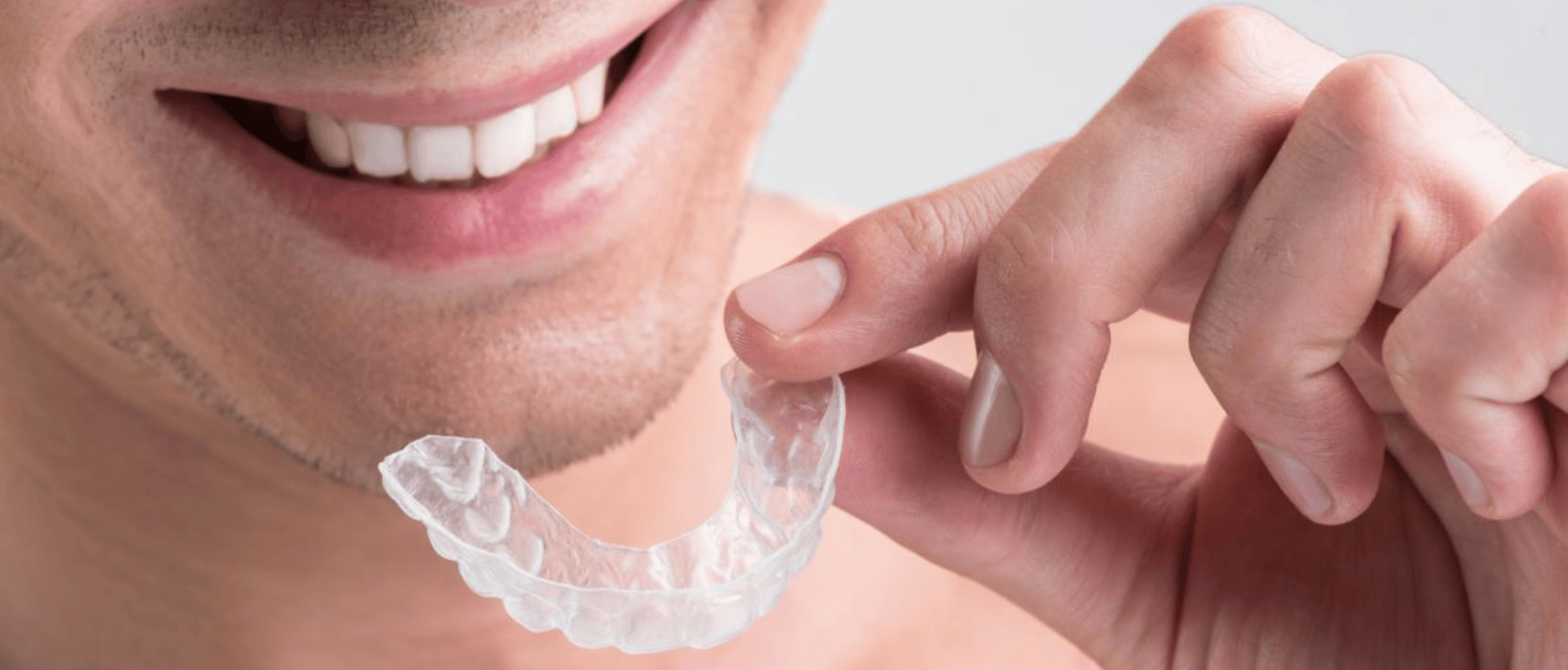 blog inner thumb : Wensleydale Dental